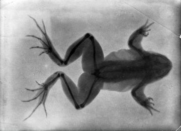 Tấm ảnh X-quang đầu tiên của nhân loại này đã làm vợ của nhà phát minh ra nó vô cùng hoảng hốt