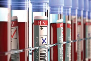 Xuất hiện bệnh nhân thứ 3 trên thế giới được chữa khỏi HIV