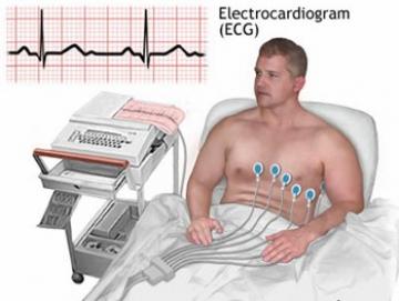 Máy điện tim - Tổng quan về máy điện tim